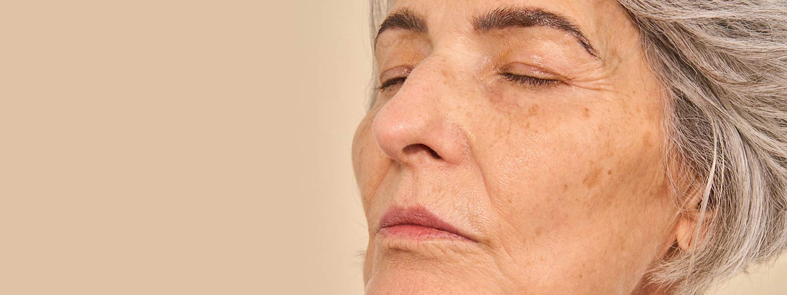 Marcas de expressão: por que surgem e como suavizar