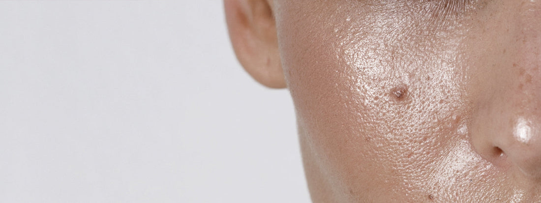 Pele oleosa: você sabe como cuidar?