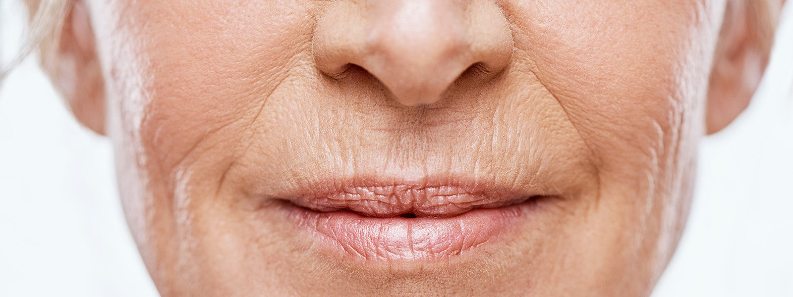 Rugas: como prevenir e tratar