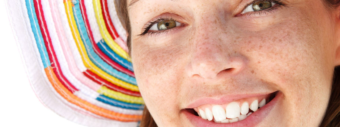 Sardas no rosto: o que causa e como tratar