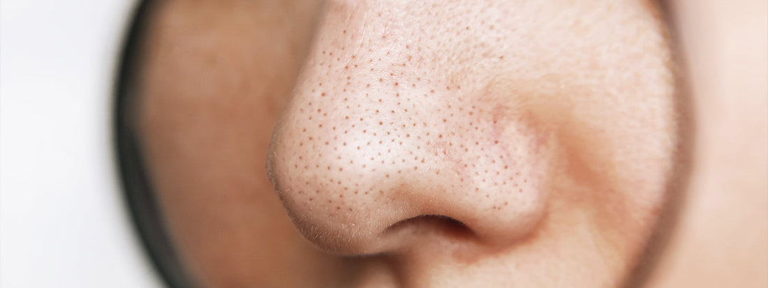 Tipos de cravos: quais as diferenças entre cravos brancos e pretos