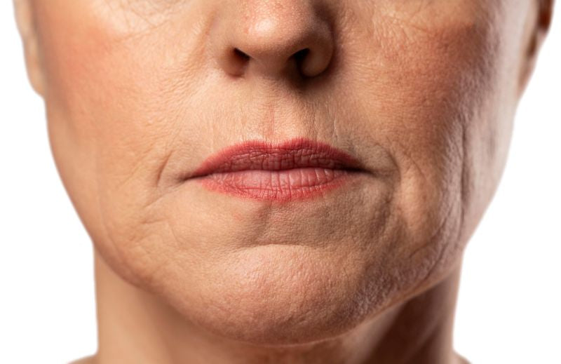 Bigode chinês: dicas de como diminuir e tratar