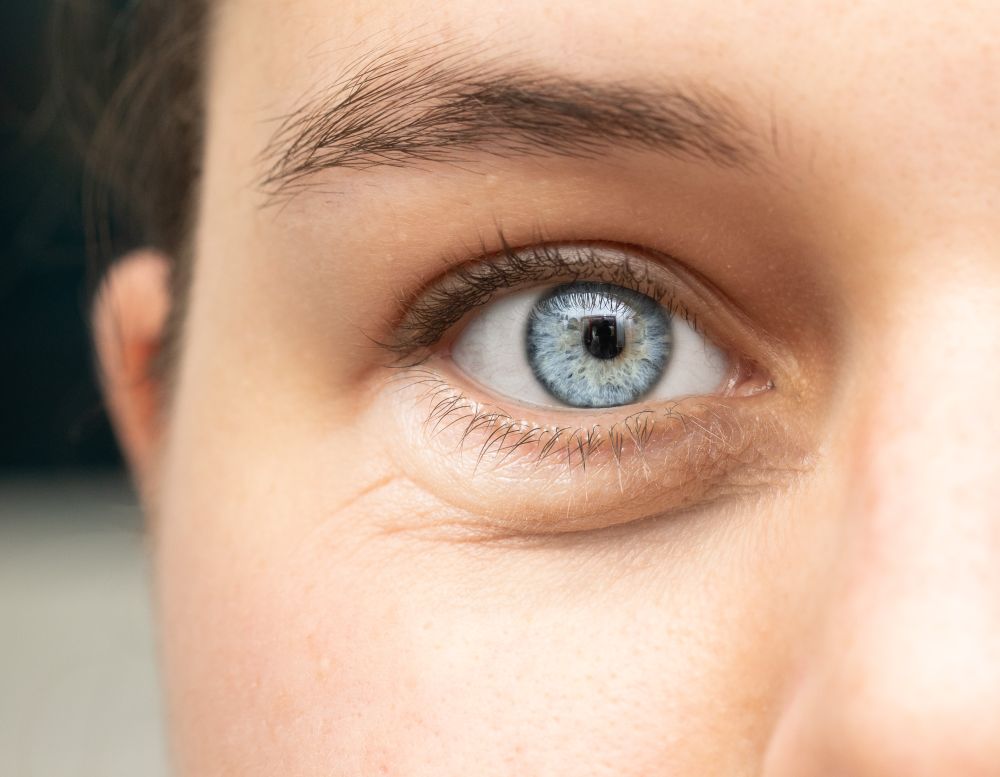 Como tirar bolsas dos olhos: dicas para remover
