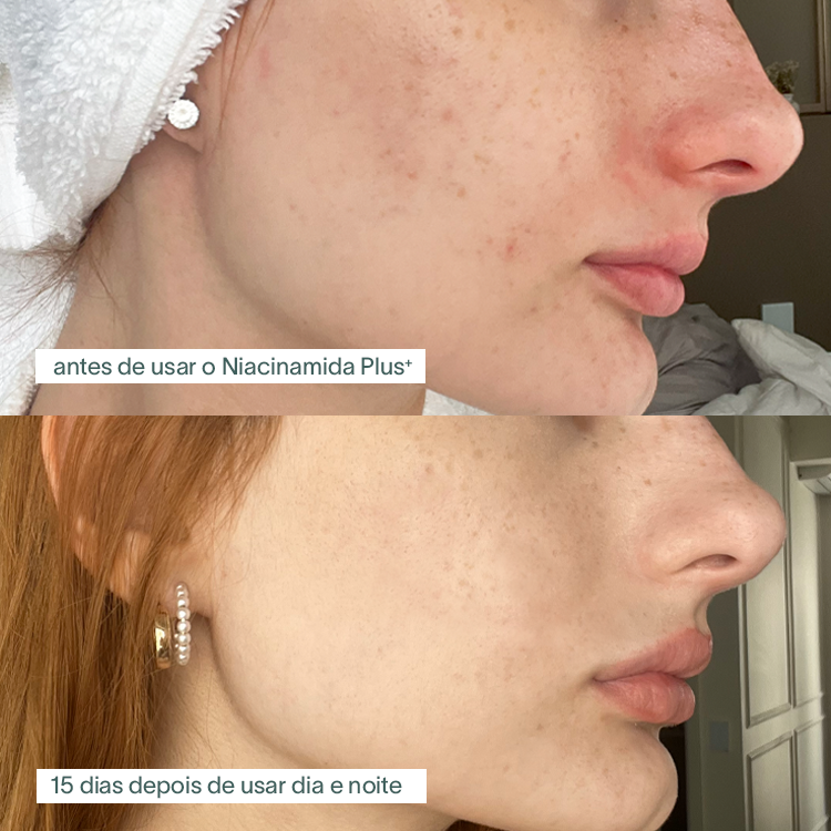 Sérum Facial Skindrops Niacinamida Plus